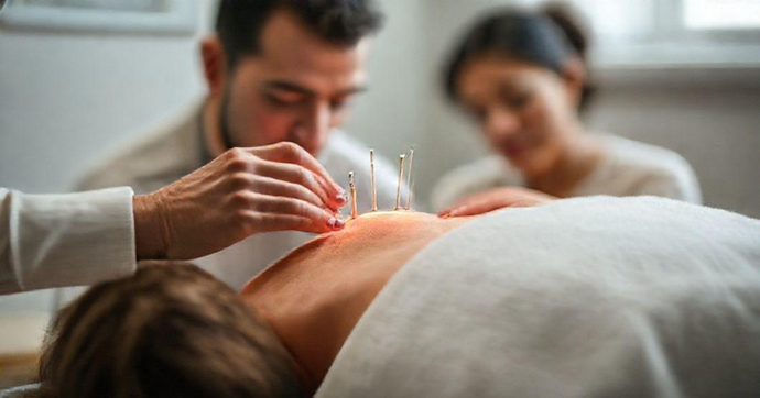 Acupuntura em Santo André: Benefícios para Saúde e Bem-Estar