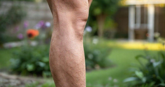 Aplicação de Glicose no Tratamento de Vasos Vazinhos: Benefícios para a Saúde Vascular