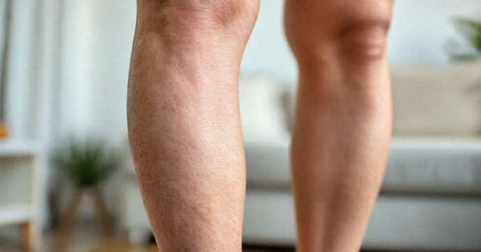 Aplicação de Vasos: Benefícios e Cuidados para a Saúde Venosa