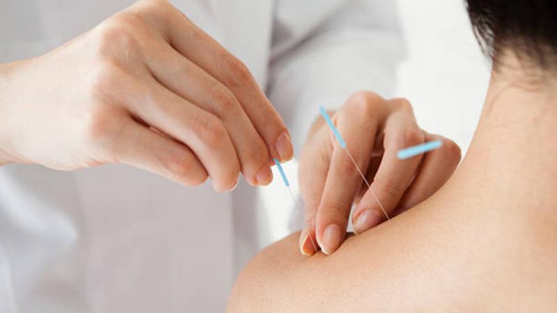 Fisioterapia e Acupuntura: Transformando sua Saúde