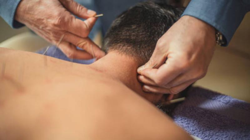 Acupuntura: Benefícios Essenciais para o Seu Bem-Estar Diário