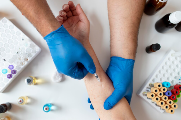 Benefícios da Aplicação de Glicose no Tratamento de Vasos Sanguíneos Visíveis