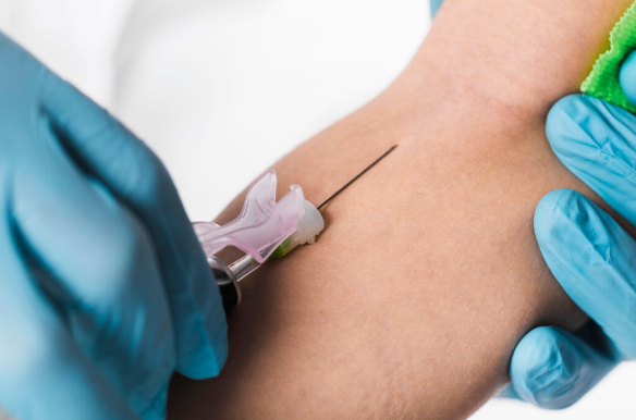 Entenda os Custos e Benefícios da Aplicação em Vasos Sanguíneos para Sua Saúde